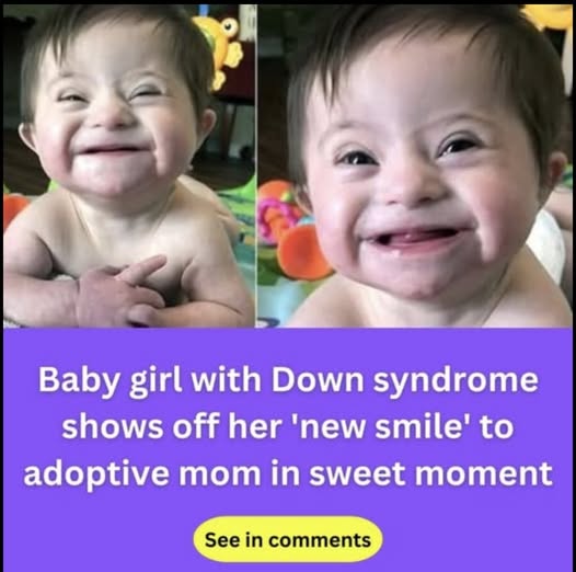 Adopted baby with Down syndrome goes viral after smiling for mom