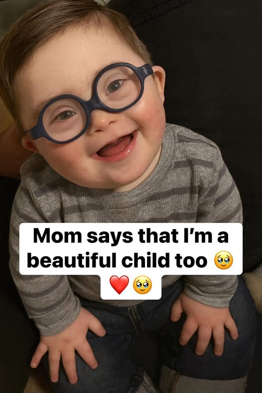 The Boy Who Taught the World What True Beauty Is