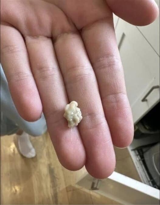 I sneezed 4-5 times yesterday and then felt something tickling my throat. Today, my throat is completely clear after this little thing came out. What is this? Well, you’d better know